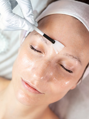Facial skin peel treatments